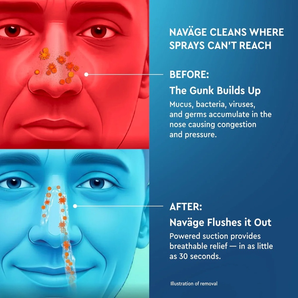 Naväge Machine - Picture 7 of 12